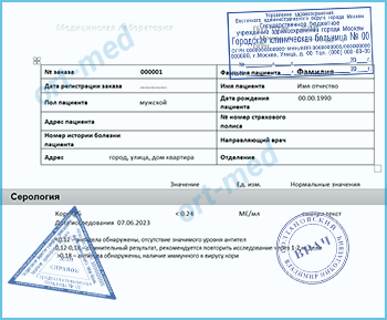 Купить тест на антитела к вирусу кори Купить справку тест на антитела к вирусу кори в Подольске официально